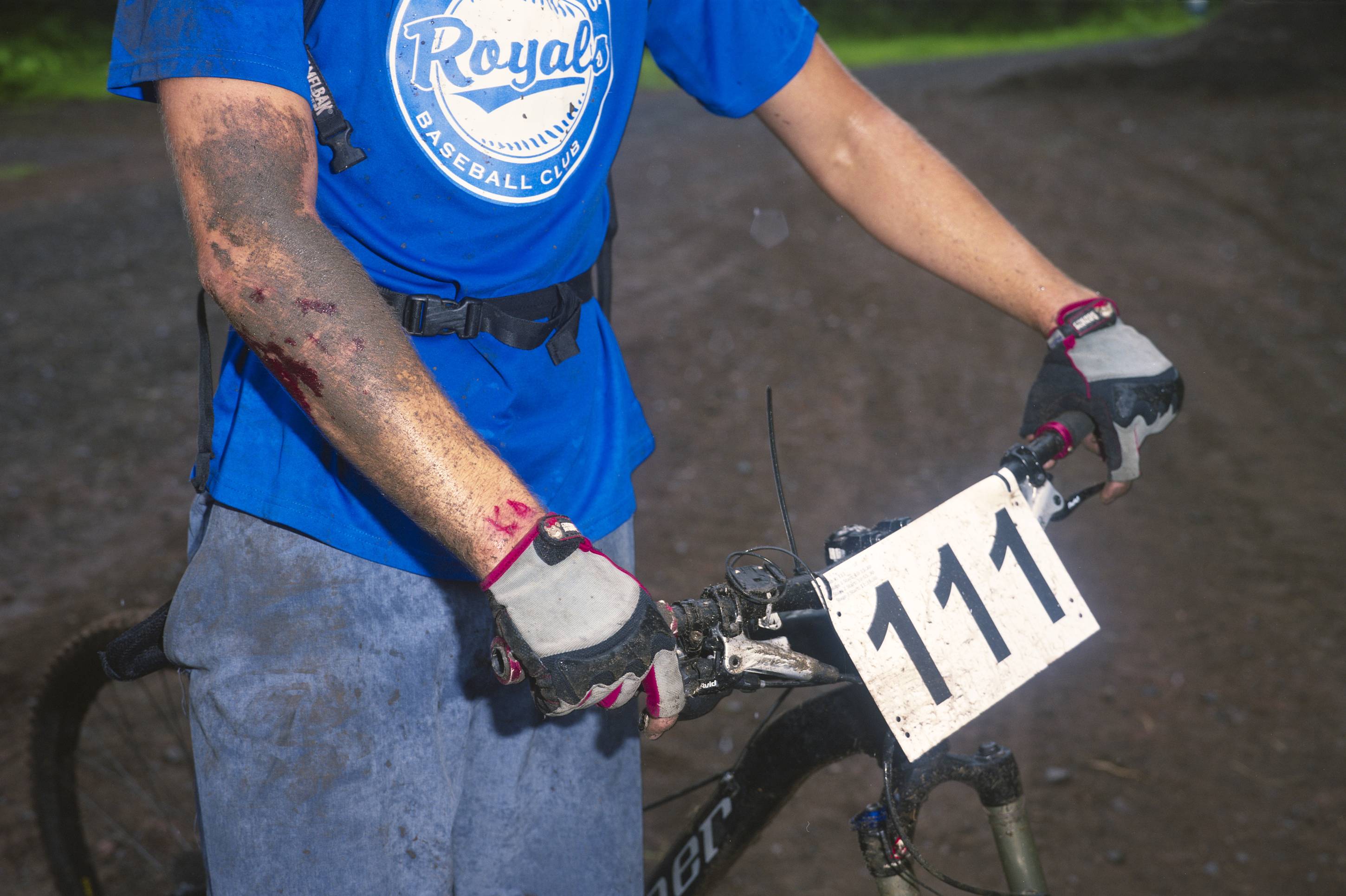 Crashed Mountain Biker, Duluth, Minnesota, August 2014